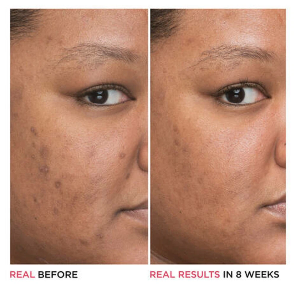 IT Cosmetics Bye Bye Dark Spots Niacinamide Serum 8 IT Cosmetics Bye Bye Dark Spots Niacinamide Serum - Afbeelding 6