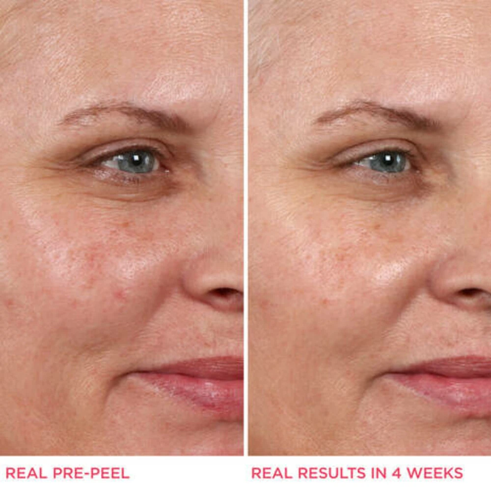 IT Cosmetics Hello Results BabySmooth Glycolic Peel + Carin Oil 6 IT Cosmetics Hello Results BabySmooth Glycolic Peel + Carin Oil - Afbeelding 4