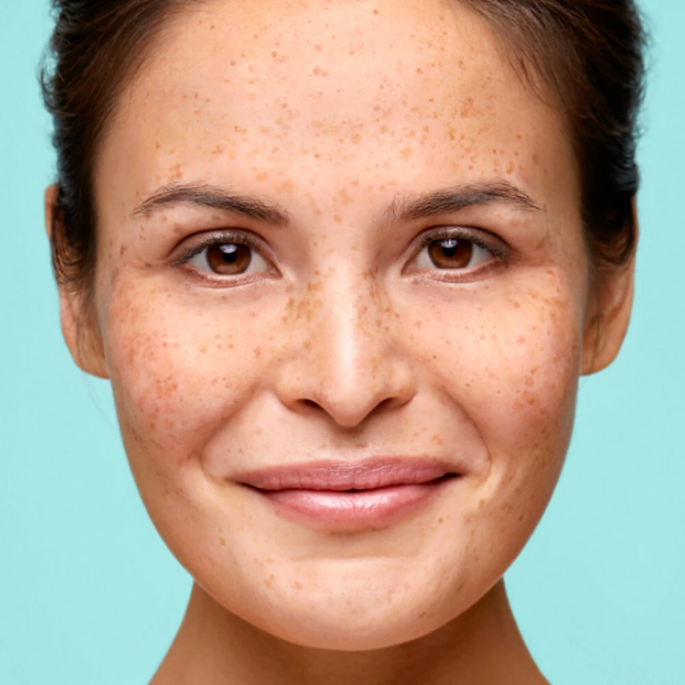 2x Biodermal Reinigende Mousse Gevoelige Huid 4 2x Biodermal Reinigende Mousse Gevoelige Huid - Afbeelding 2